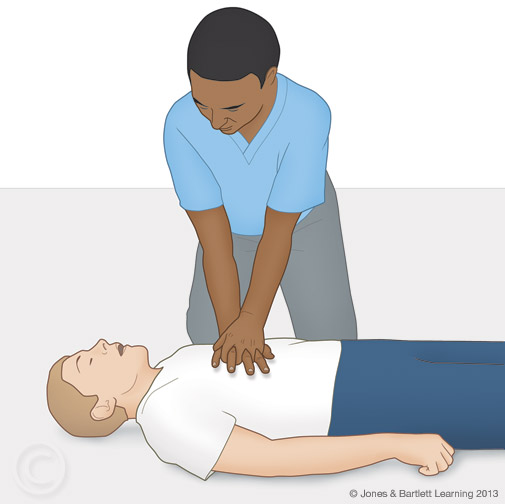 Illustration of CPR technique
